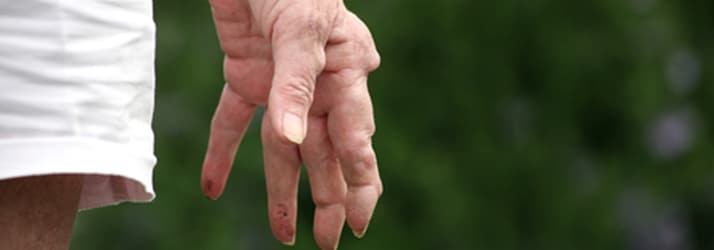 Chiropractic Ottawa ON Arthritis Relief Chiropractic Ottawa ON Arthritis Relief